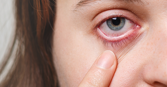 Cornea