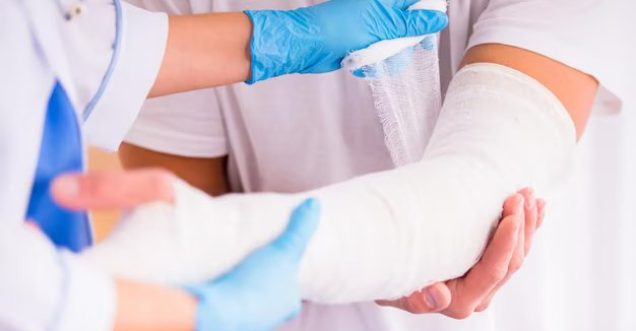 Arm Transplant
