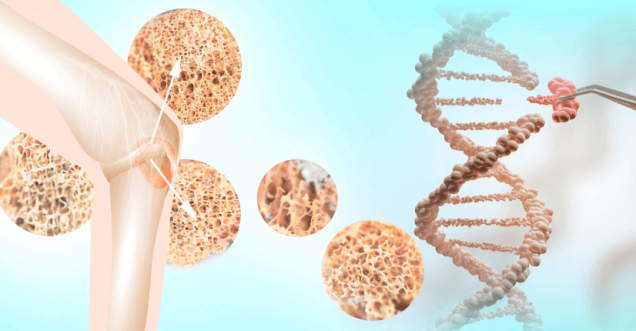 Bone Marrow Transplantation