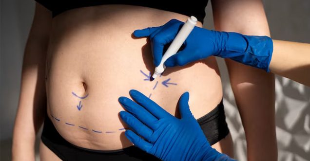 Pancreas Transplant